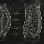 diastasis avant apres schema abdomen